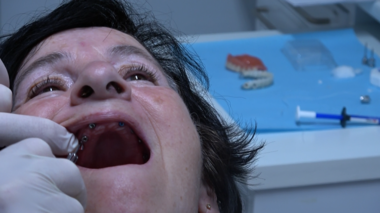 (Bilateral Sinus Solution™) Tecnica Chirurgica che viene eseguita solo dall’equipe di Impalntologia Network